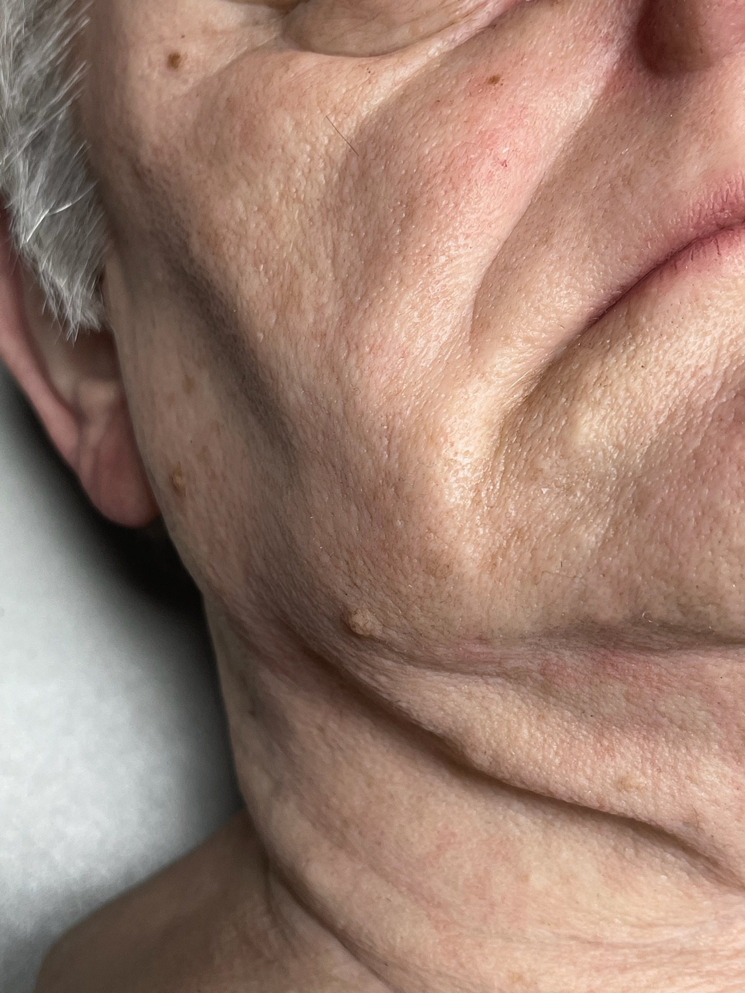 Leichenfigur Setdetail